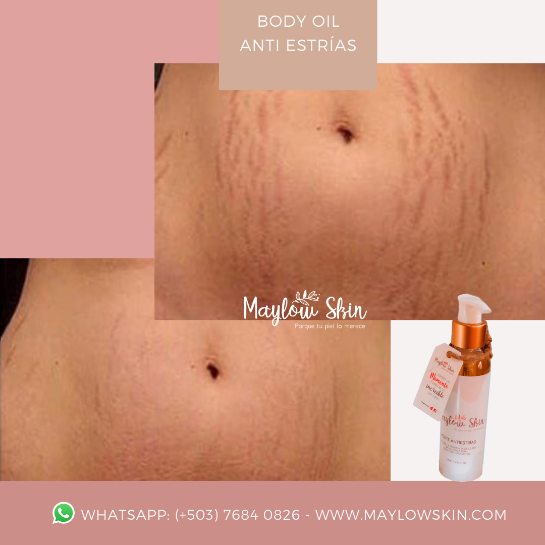Body Oil Antiestrías - Imagen 5